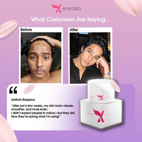 Cream X Emirates Face Whitening Cream